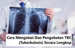 Cara Mengatasi Dan Pengobatan TBC (Tuberkulosis) Secara Lengkap