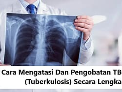 Cara Mengatasi Dan Pengobatan TBC (Tuberkulosis) Secara Lengkap