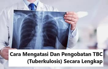 Cara Mengatasi Dan Pengobatan TBC (Tuberkulosis) Secara Lengkap