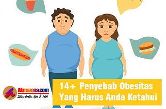 14 Penyebab Obesitas Yang Harus Anda Ketahui