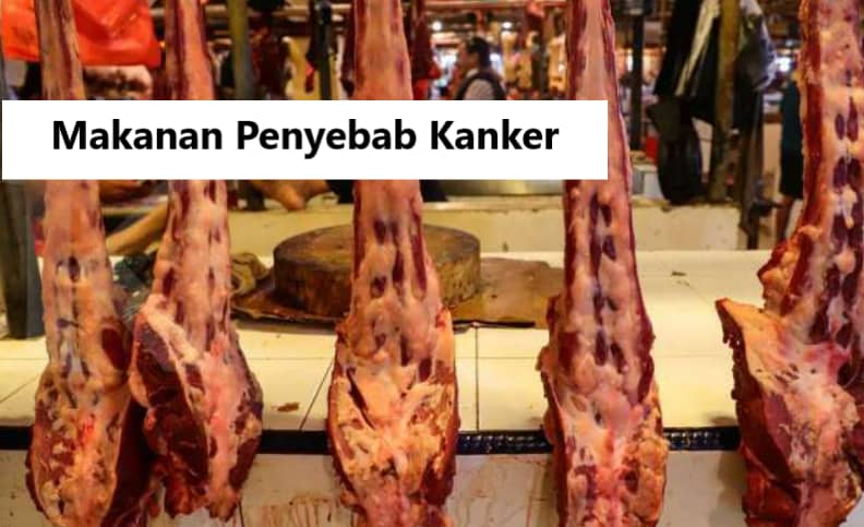 Hati-Hati, Ini 15 Daftar Makanan Penyebab Dan Pemicu Kanker